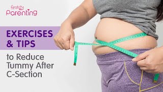 How to Reduce Tummy Fat After Csection Delivery Easy Exercises amp Tips [upl. by Teraj]