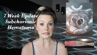 Surrogate Pregnancy 2 Subchorionic Hematoma 7 Weeks Pregnancy Update [upl. by Pyszka83]