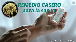 Remedio casero para la sarna [upl. by Settera]