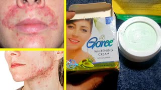 Goree Beauty Cream for Instant Skin Whitening Cream [upl. by Volin]