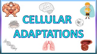 Hyperplasia amp Atrophy  Cell Adaptations 23  General Pathology  EOMS [upl. by Anerehs339]