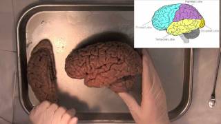 MIT Introduction to Neuroanatomy Series Part 1 [upl. by Itnuahsa145]