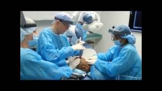 Robotic Hair Transplant Graft Harvesting with ARTAS FUE System [upl. by Varini]