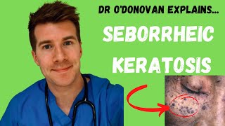 Explaining Seborrheic Keratosis  With Dr ODonovan [upl. by Alih36]