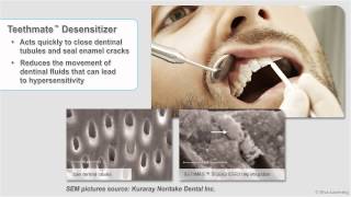 Teethmate Desensitizer [upl. by Gipson]