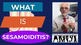 What Is Sesamoiditis [upl. by Akemehc]