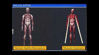 CBSE Class 11 Biology  Skeletal System [upl. by Ennaeiluj]