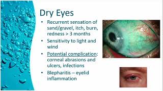 What is Sjögrens Syndrome Eye Doctor Explains [upl. by Moriarty77]