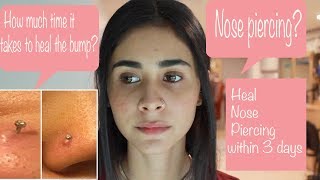 Nose Piercing Aftercare  Nose Pin or Nose Ring  Quick Heal [upl. by Kenneth]