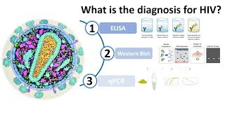 Diagnosis of HIV AIDS [upl. by Candi]