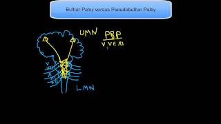 Bulbar Palsy versus Pseudobulbar Palsy [upl. by Omari]