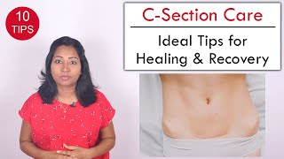 10 Tips to help Heal C Section wound  Post Delivery Care [upl. by Eynobe]