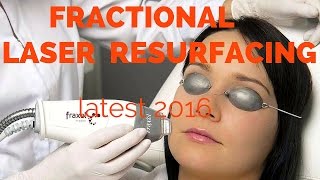 Fractional laser resurfacing dermatologist review [upl. by Raimund138]