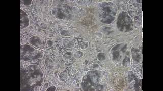 Heart Cells derived from iPSC Stem Cells beat in Culture Dish [upl. by Anilam170]