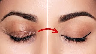 Droopy Eyelid ptosis Treatment and Surgery [upl. by Isbel]