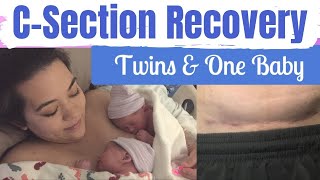 CSECTION RECOVERY TWINS amp BABY  CSection Recovery Tips  Postpartum Care  Mai Zimmy [upl. by Efal]