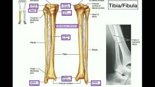 Anatomy  Specific Parts of the Tibia amp Fibula  Left vs Right [upl. by Munafo570]