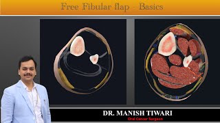 Free Fibula Flap Anatomy  Basics  Part 2  StayHome and learn WithMe [upl. by Earezed]