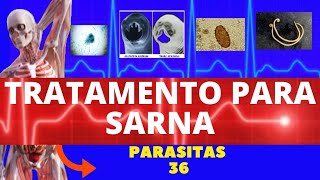 TRATAMENTO PARA SARNA HUMANA ESCABIOSE  SARCOPTES SCABIEI HOMINIS  PARASITOLOGIA  INFECTOLOGIA [upl. by Strader]