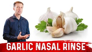 How Does Nasal amp Sinus Irrigation Work  shortened version [upl. by Aztirak]