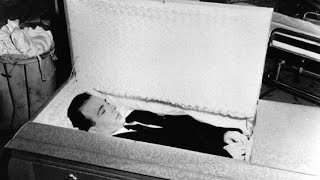 LEE HARVEY OSWALD AUTOPSY amp EXHUMATION PHOTOS [upl. by Llewen878]