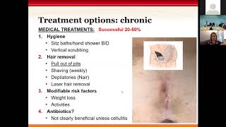 Project ECHO SICK Pain in the Butt Pilonidal Disease [upl. by Radnaxela]