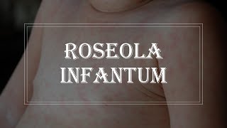 Pediatrics Infectious disease  Roseola infantum exanthem subitum [upl. by Hamrnand]