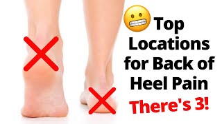 Back of The Heel Pain Locations [upl. by Simon]