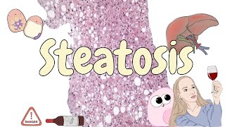 Steatosis  liver pathology [upl. by Jonathon]