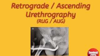 Retrograde  Ascending Urethrography Procedures preparation guide [upl. by Asihtal]