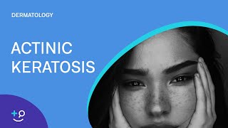 Actinic Keratosis Dermatology [upl. by Leissam133]