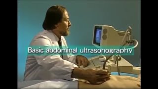 How to do abdominal ultrasound examination [upl. by Laaspere]